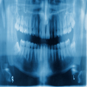 Biting Bullets