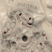 Disritmia