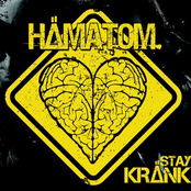 Hämatom – Stay Kränk