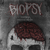 Biopsy
