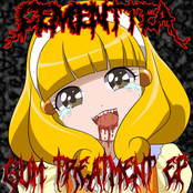 Gum Treatment EP