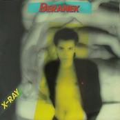 X-Ray