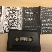 Dismembered Corpse