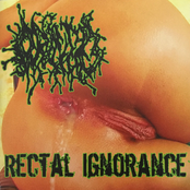 Rectal Ignorance