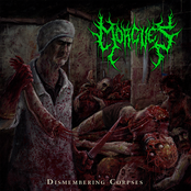 Dismembering Corpses