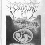 life and death