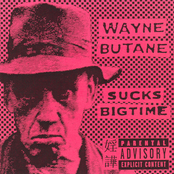 Sucks Bigtime