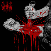 Scars