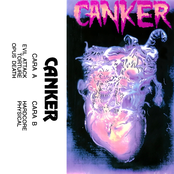 Canker
