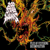 200 Stab Wounds – Piles of Festering Decomposition
