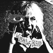 We Speak, We Bleed