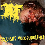 Exquisite Mucopurulence
