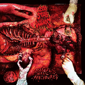200 Stab Wounds – Hands of Eternity