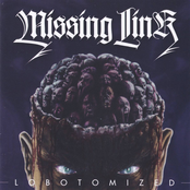 Lobotomized