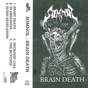 Brain Death