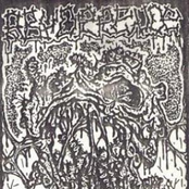 Excremental Excrescence on the Vocal Cords