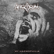 My Haemophilia