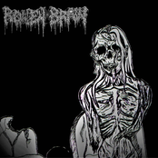 Rotten Brain