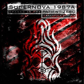 Supernova 1987A