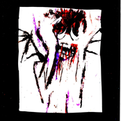 toothache