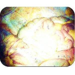 Avatar for Occlusion