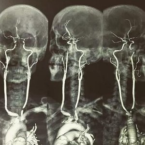 22.حنين.ɐɓoɐ ǝs ıɐǝl؛////