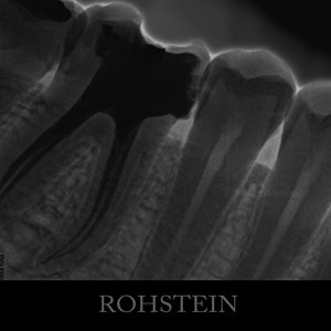 ROHSTEIN