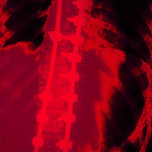 189.5 [Explicit]