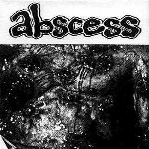 Abscess