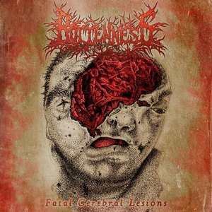 Fatal Cerebral Lesions