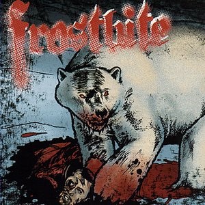 Frostbite