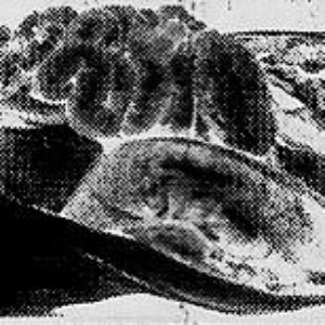 Avatar for cORPOS mUTILADOS