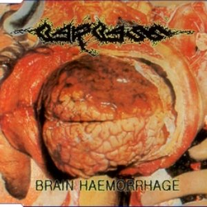 Brain Haemorrhage