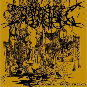 Duodenal Suppuration