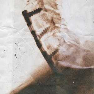 Spleen / Ever Left