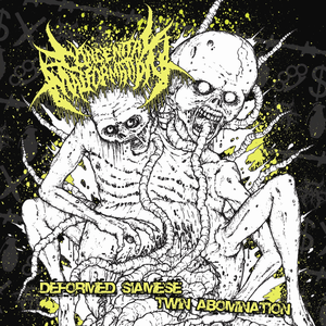 Siamese Twin Abomination by Congenital Malformation