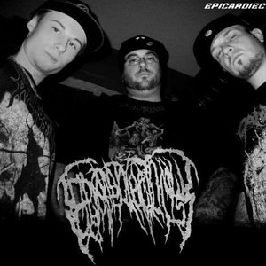 Avatar for Epicardiectomy