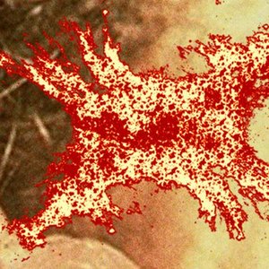 Avatar for Haemophilus Ducreyi