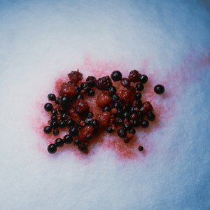 Poison Berry