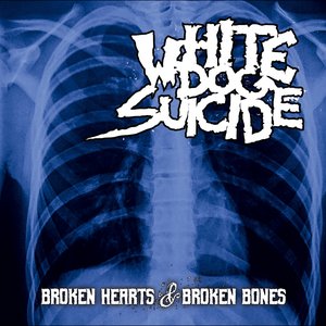 Broken Hearts & Broken Bones