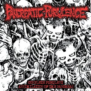Complete Purulent Annihilation Of The Pancreas