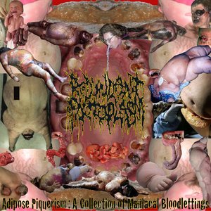 Intravenous Leptosporosis