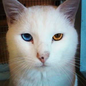 Heterochromia Iridis