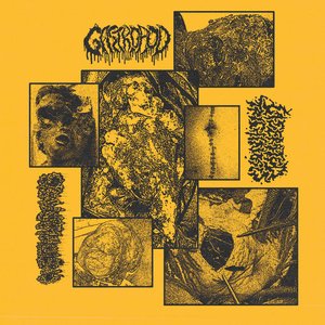 split w Gastropod/ Lacerated Trichinosis