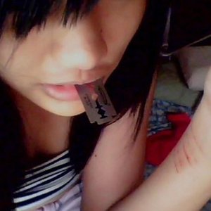 scars on my wrist