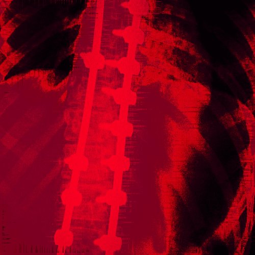 189.5 [Explicit]