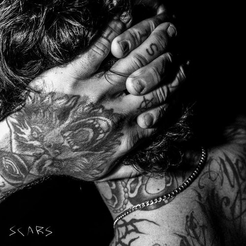 SCARS