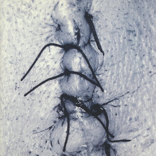 Infliction