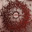 Retrogression