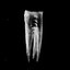 Chalk Teeth